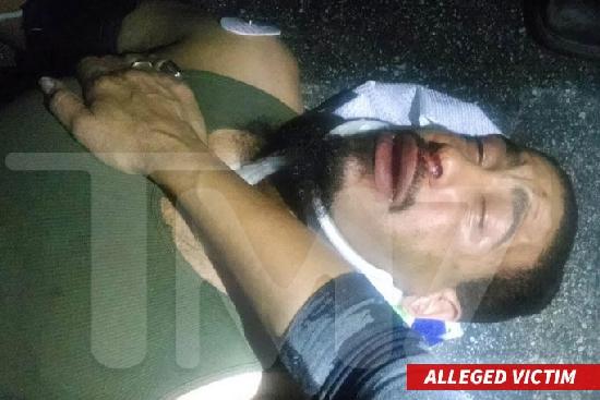 columbus-short-bar-fight-victim